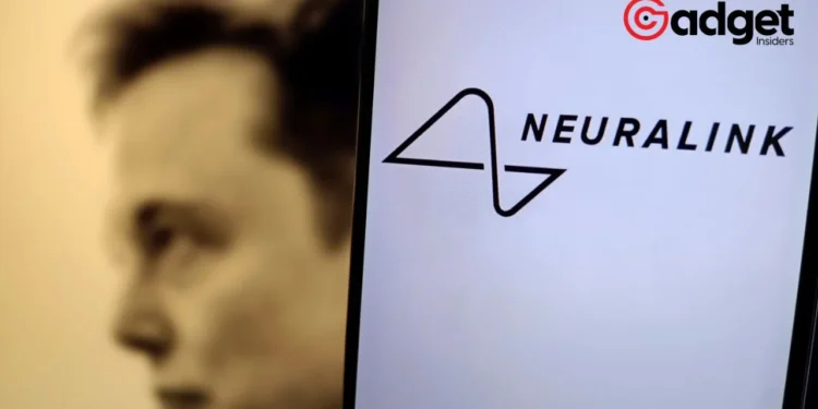 The Ethical and Security Challenges of Neuralink's Brain Implant Technology