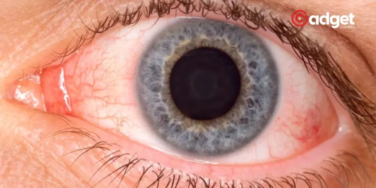 Rising STD Crisis How Syphilis Is Threatening Vision Across the U.S