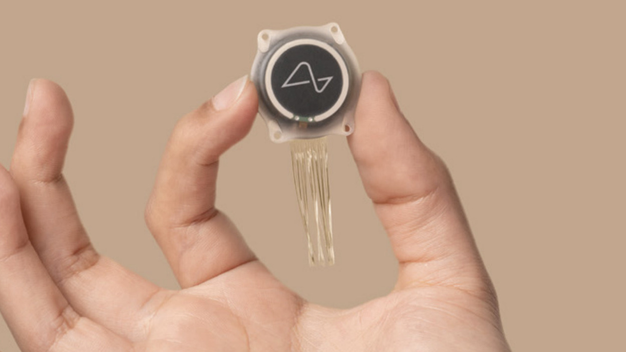 Brain Tech Update First Human with Neuralink's Implant Experiences Major Changes and Improvements