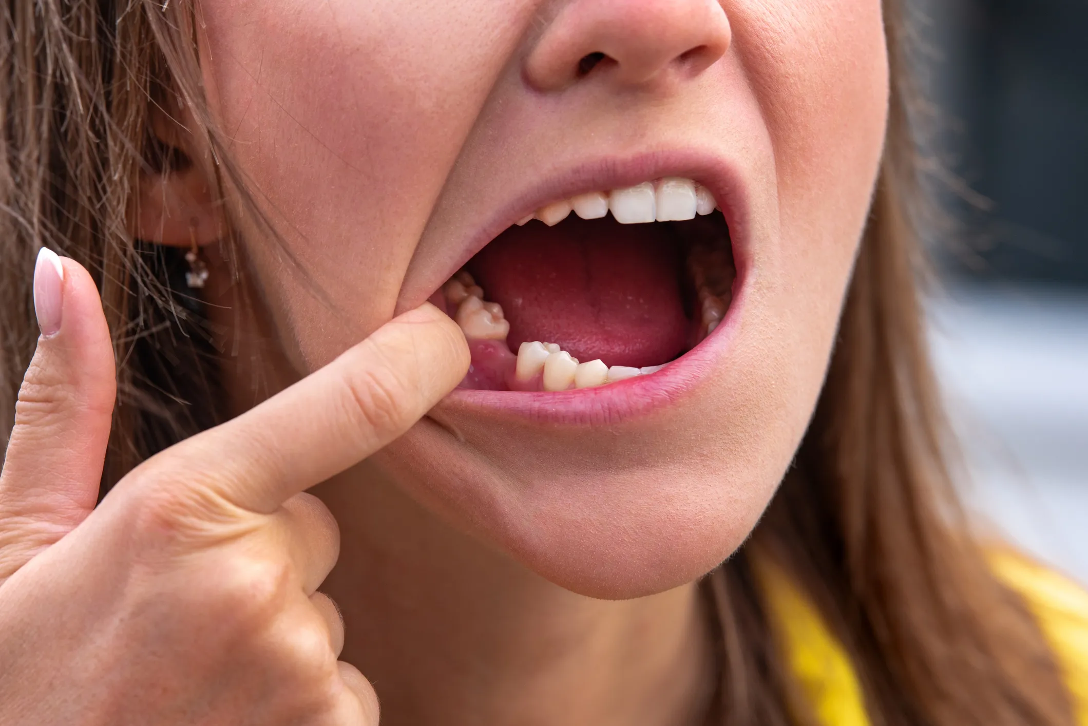 Breaking New Ground: Japan's Trailblazing Trials to Grow Teeth Naturally Starting September 2024