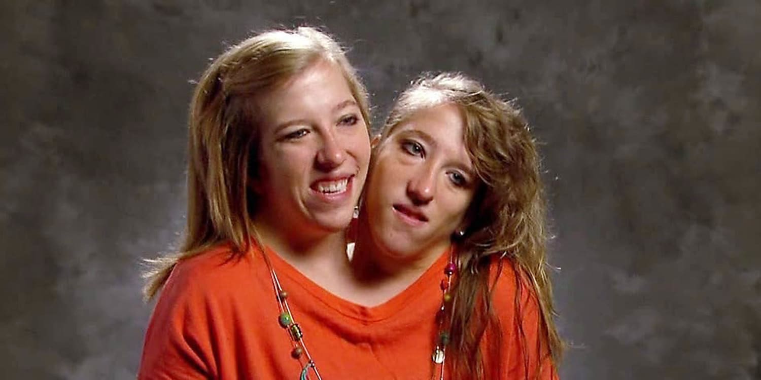 Abby and Brittany Hensel's Remarkable Wedding Journey as Conjoined