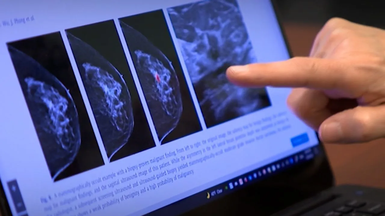 How ChatGPT Helped One Woman Detect Cancer and Save Her Life